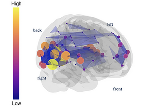 A translucent side view of a brain containing a network of nodes and edges, the nodes sized and colored from purple (low) to yellow (high) on a vertical color bar.